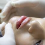 Woman's face cocked backwards with a doctor's gloved hands on her chin